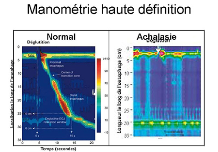 manometrie