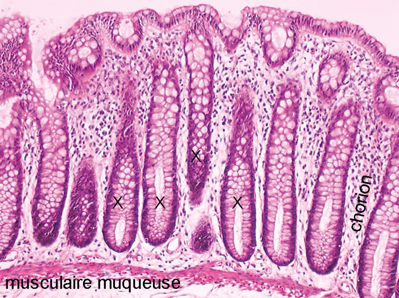 anapath colon